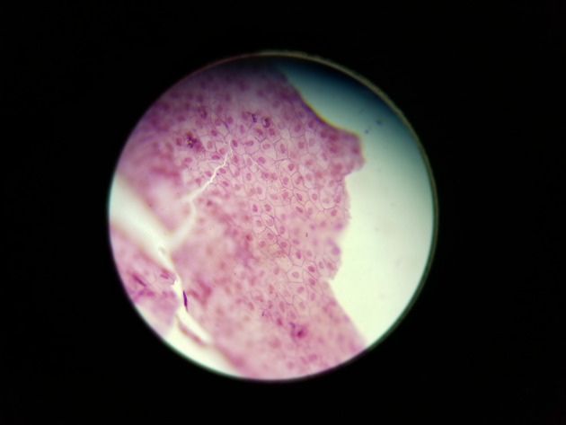 Simple Squamous Epithelium Slides - Simple Squamous Epithelium 07 100X